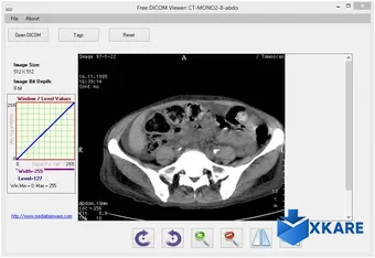Free DICOM Viewer